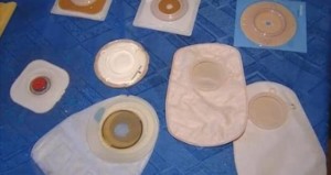Osobe sa stomom traže poštovanje pravilnika